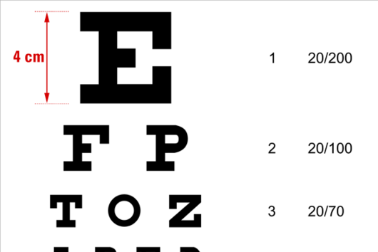 Do a free eye test now!